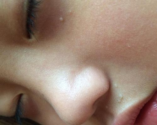 拥有美容的秘诀（轻松减掉脸上多余肉肉）  第3张