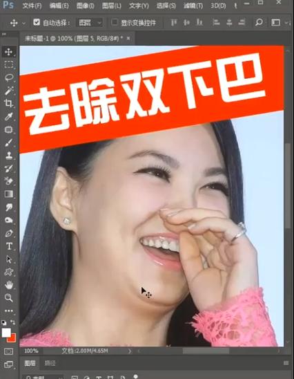 如何减掉双下巴（有效方法和技巧）  第3张