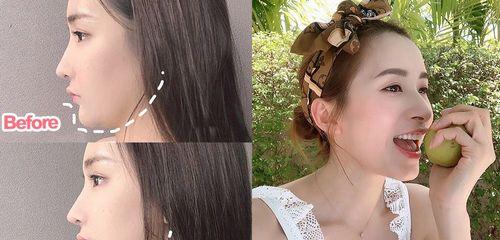 如何减掉双下巴（有效方法和技巧）  第2张