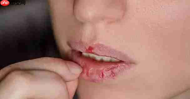 秋冬季节嘴唇易干裂舔嘴唇有助于保湿吗  第1张