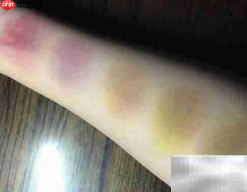 black and blue的含义解析  第1张