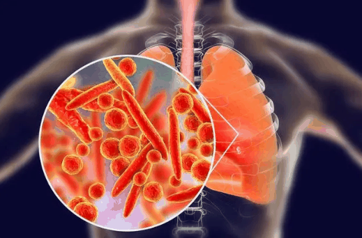 今年支原体肺炎高峰期是几月到几月?2023支原体肺炎高发季节是什么时候
