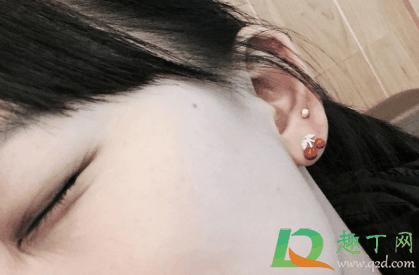 耳后窝酸痛是怎么回事2