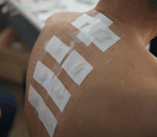 三伏贴痒是在排毒吗?三伏贴痒是拔出湿气来了吗插图1 三伏贴痒是在排毒吗2