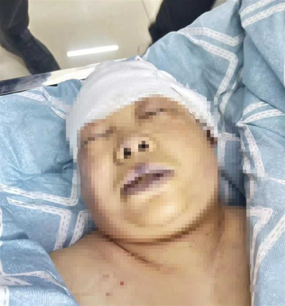 祖孙家中遇袭老人身亡两儿童重伤 祖孙为何在家中被害