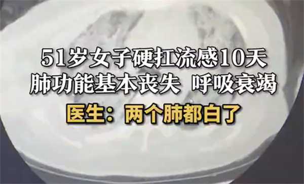 女子扛流感10天两个肺都白了 流感可以扛过去吗