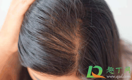 头皮长痘可以擦红霉素吗?头皮长痘痘很痒怎么办