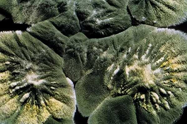 下一种抗生素可能已经毫无用处