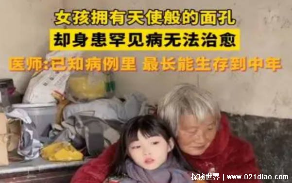 女孩拥有天使般面孔却身患不治之症 医生只能叹息插图