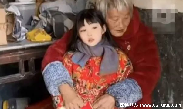 女孩拥有天使般面孔却身患不治之症 医生只能叹息插图1