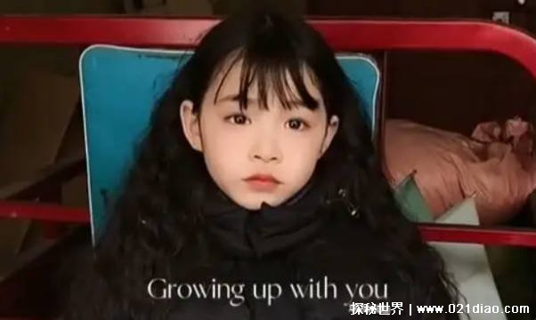 女孩拥有天使般面孔却身患不治之症 医生只能叹息插图2