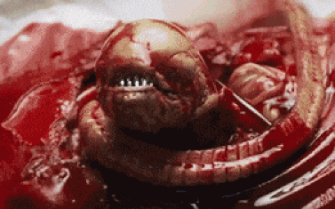 医生从患者肚子里扯出一条活鳗鱼 这不比异形还刺激