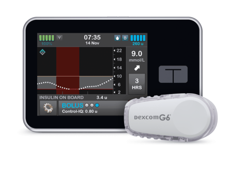 英国将为数万名糖尿病患者植入“人工胰腺”插图 英国将为数万名糖尿病患者植入“人工胰腺”