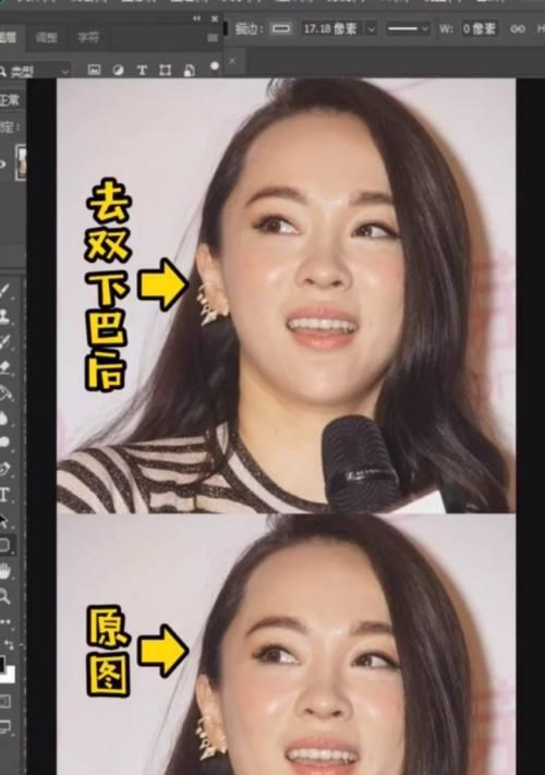 如何减掉双下巴（有效方法和技巧）