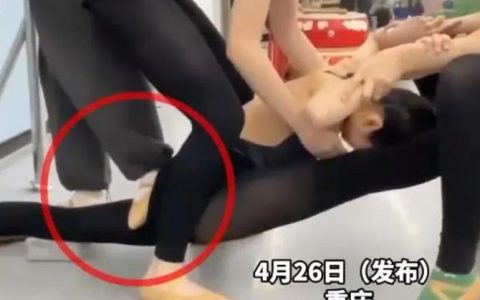 舞蹈老师踩断学生腿却只愿意赔5万 影响学生的高考