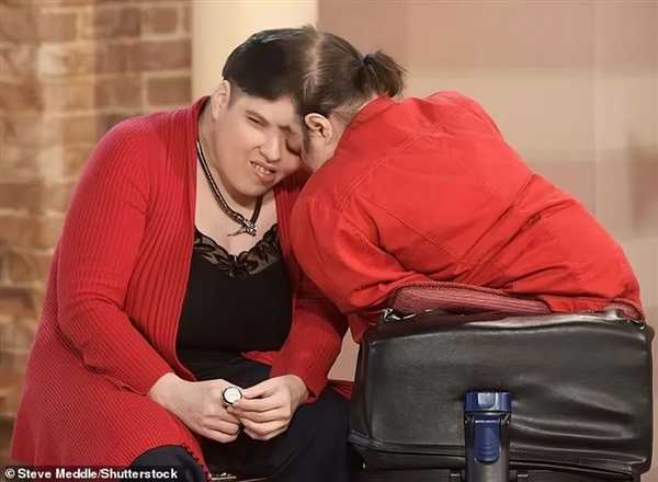 美国最年长连体人62岁去世:妹妹46岁变性 支持姐姐结婚生子插图 美国最年长连体人62岁去世:妹妹46岁变性 支持姐姐结婚生子