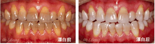 甘草片和红药水等为什么买不到了:知道真相的我有点慌插图7 甘草片和红药水等为什么买不到了:知道真相的我有点慌