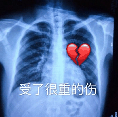 暴雪设计师开始哄玩家？《暗黑4》突然开窍，首次和“爽刷”沾边！