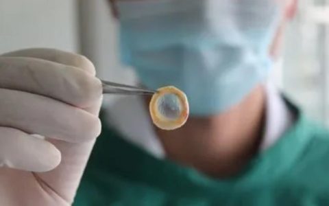 男子确诊胃癌提前一年安排身后事 捐献眼角膜照亮别人！