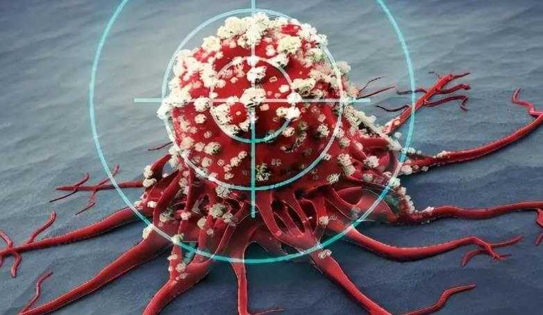 男子为饿死癌细胞饿瘦50斤离世 医生提醒：不建议这样做