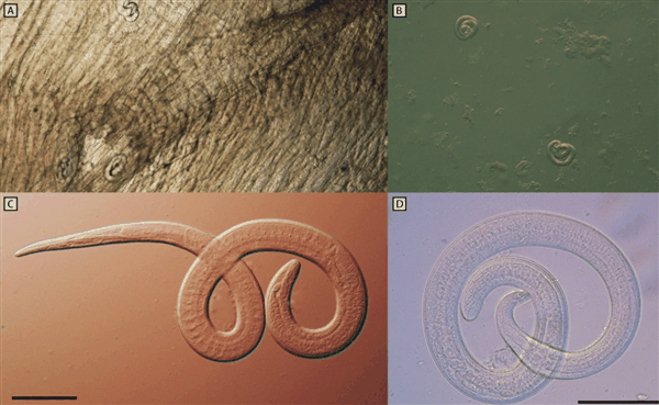 吃了未熟透的熊肉：美国一家6口全部感染致命旋毛虫病