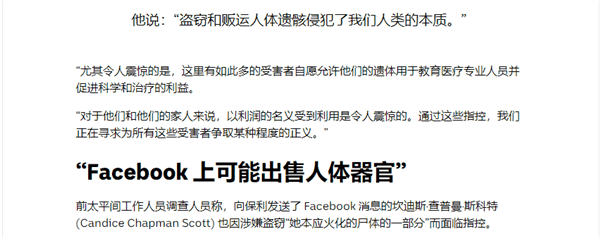 7000美元就能买到一副人体骨架！美国小伙创业网上卖人骨