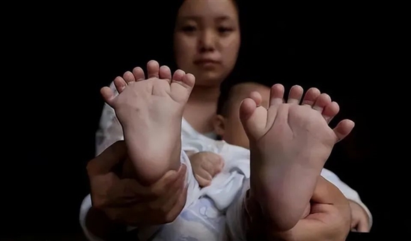 5根不够、6根最优!英国发明穿戴式第六指:单手就能开汽水插图10 5根不够、6根最优!英国发明穿戴式第六指:单手就能开汽水