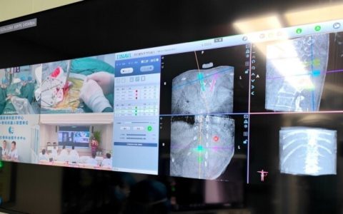 5G技术助力骨科手术！黄山新晨医院今天这台骨科手术满满的科技感