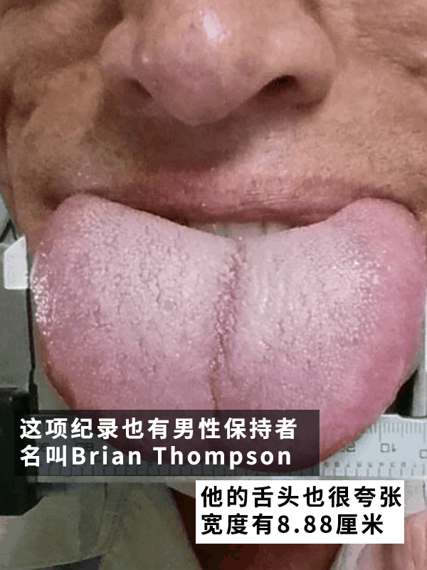 美国一姐姐拥有世界最宽的舌头!一次性可吃四个棒棒糖插图6 美国一姐姐拥有世界最宽的舌头!一次性可吃四个棒棒糖