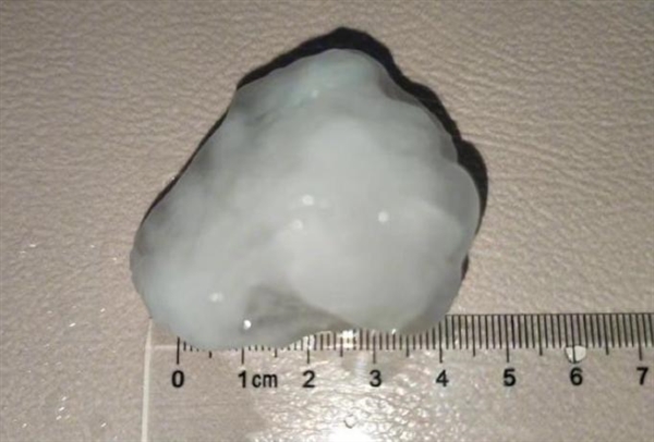 北京突降冰雹：比鸭蛋还大 户外停的车集体遭殃