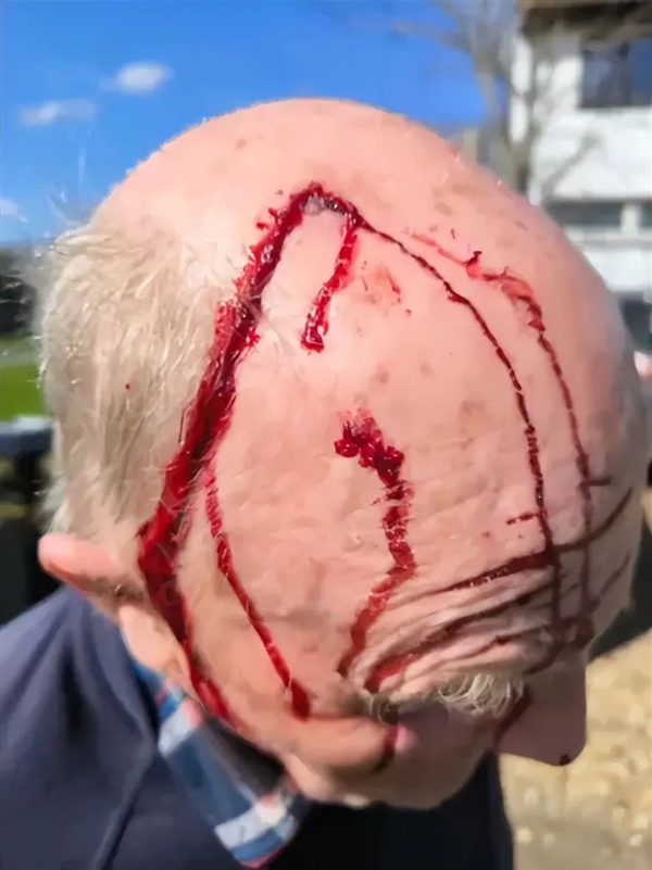 英国一只老鹰专门袭击高个男性 尤其青睐秃头