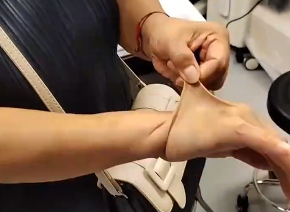 女子得罕见病:皮肤可拉伸如橡皮人 胞姐首例确诊插图1 女子得罕见病:皮肤可拉伸如橡皮人 胞姐首例确诊