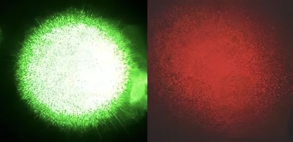 纯三色激光为何成近视人群“隐形杀手” 深度解析视觉健康陷阱