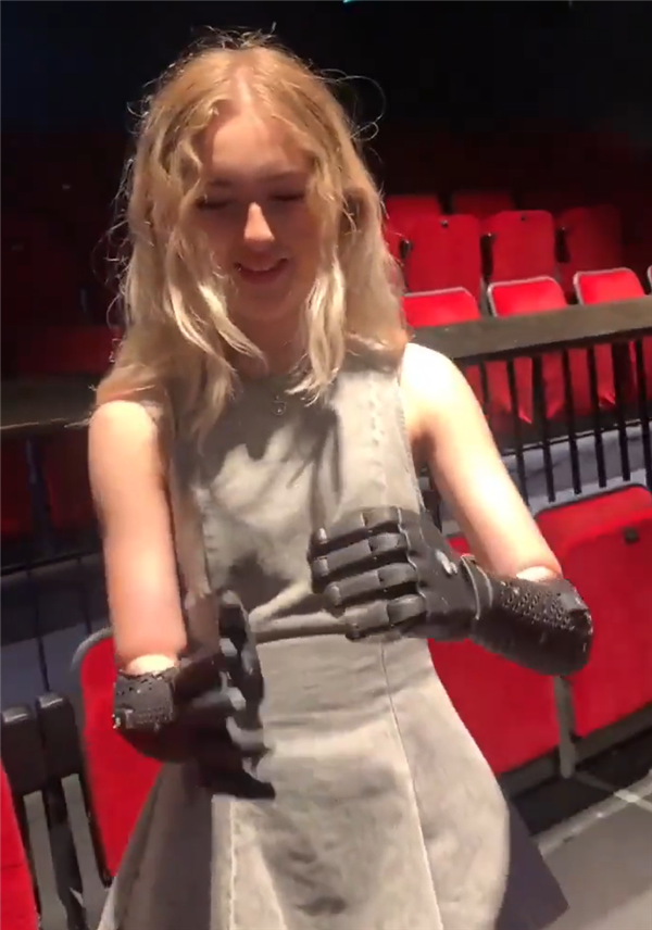 世界首款无线仿生手臂诞生！可脱离肢体自由活动