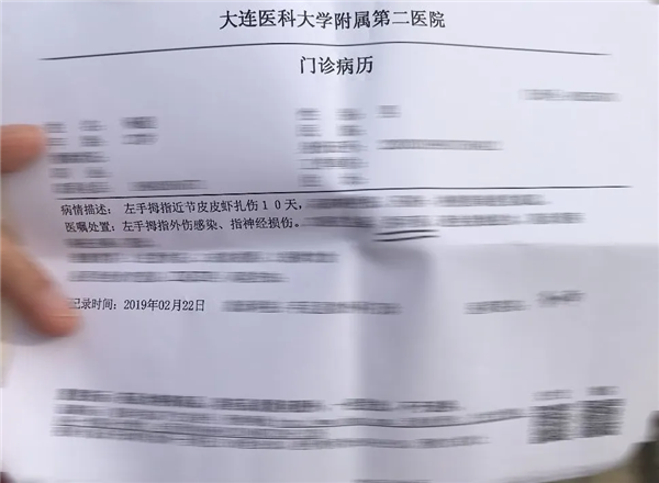 捉个皮皮虾 拇指被击穿！夏天在海边看到这些赶紧跑