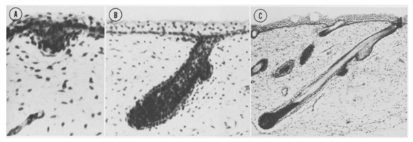 为什么每个人的头发都有“旋” 两个旋真的更聪明么