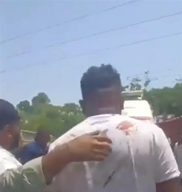 印度坠机事故幸存者跳机逃生 自行从残骸中走出