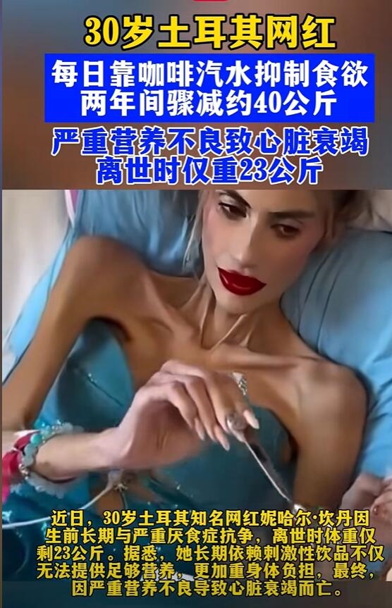 土耳其一网红离世：体重仅23公斤 终年30岁