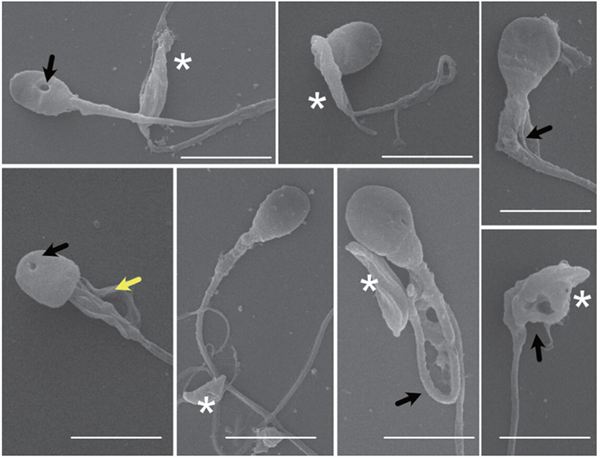 5分钟“斩首”人类精子！这种藏在猫砂中的寄生虫可能已感染全球一半人口