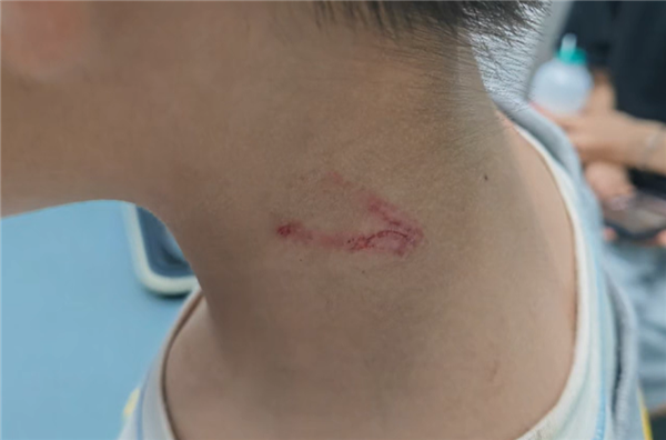 男童因多次竖中指惨遭五只猴子骑肩围殴 网友：猿辅导