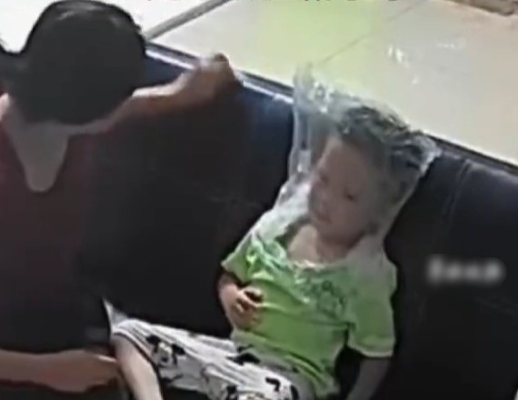 男孩呼吸困难母亲用塑料袋罩头急救 警惕呼吸性碱中毒