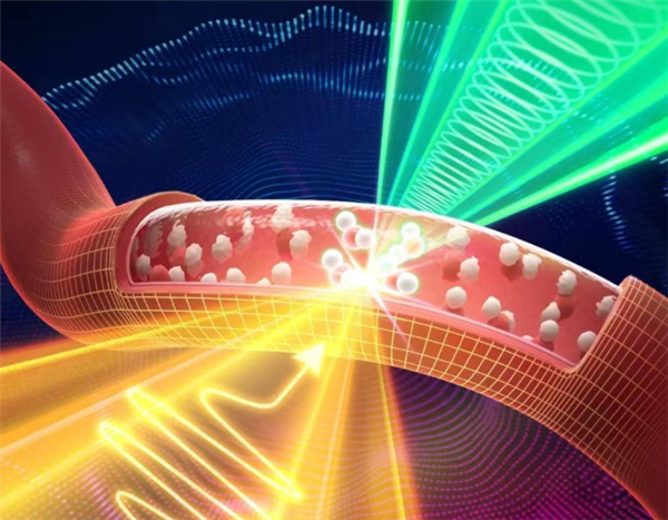 无需抽血或标记！我国科学家使无针血钠检测成为可能