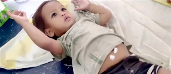 印媒称1岁男童咬死眼镜蛇奇迹生还 网友质疑造神