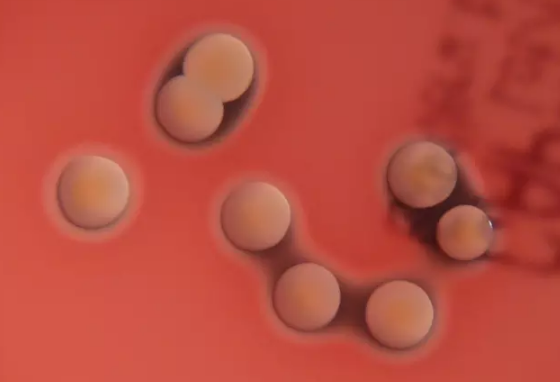 10岁男孩海边磕破脚后跟险些丧命：血压下降出现休克征兆