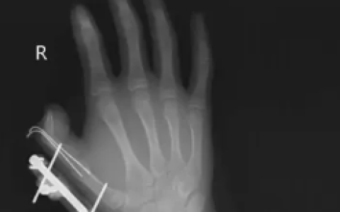 网购收到这东西 千万当心！会爆炸、会“放毒”