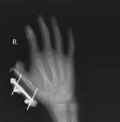 网购收到这东西 千万当心！会爆炸、会“放毒”