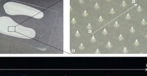 韩国开发出一种智能贴片：3D打印形成 7天内可消除青春痘