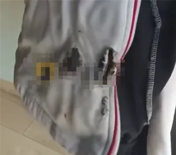 刚买一个月的充电宝突然自燃 17岁高中生校服被烧出大洞