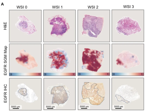 1分钟内完成！腾讯AI实现肺癌基因突变预测：精度最高可达99%