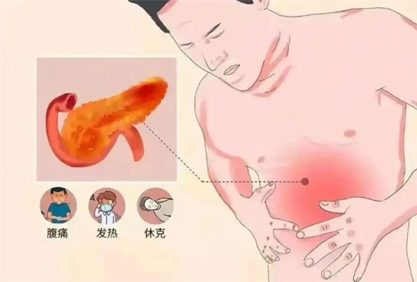 32岁男子体内抽出“牛奶血”：日常以奶茶可乐为主 偏好炸鸡火锅